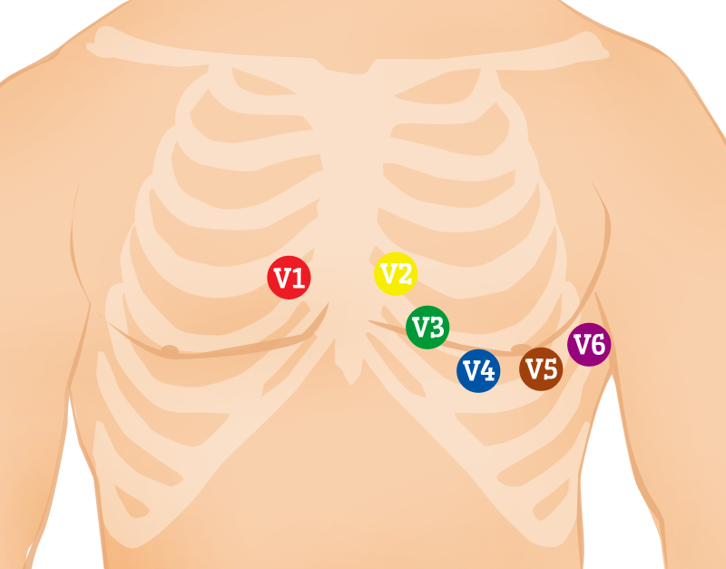 12-lead-ecg-health-fix-global