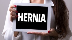 Causes of an Umbilical Hernia
